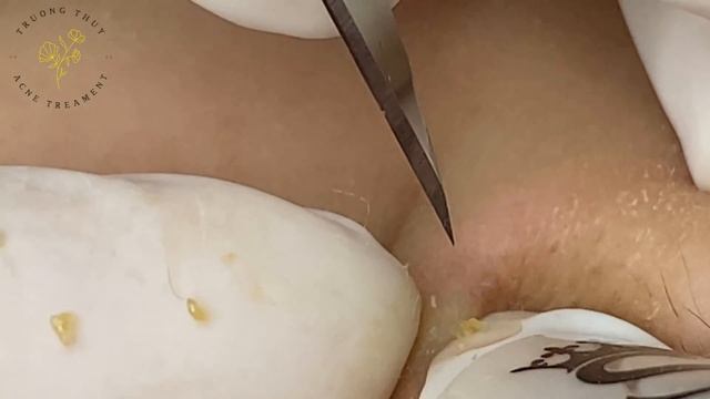 Satisfying Relaxing with Sac Dep Spa Video (#225)