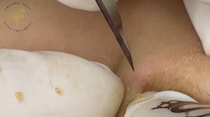 Satisfying Relaxing with Sac Dep Spa Video (#225)