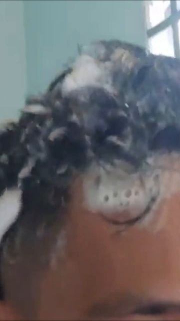 4 bước gội đầu cho ng bị nấm da đầu bạn không nên bỏ qua nếu muốn hết ngứa смотреть онлайн