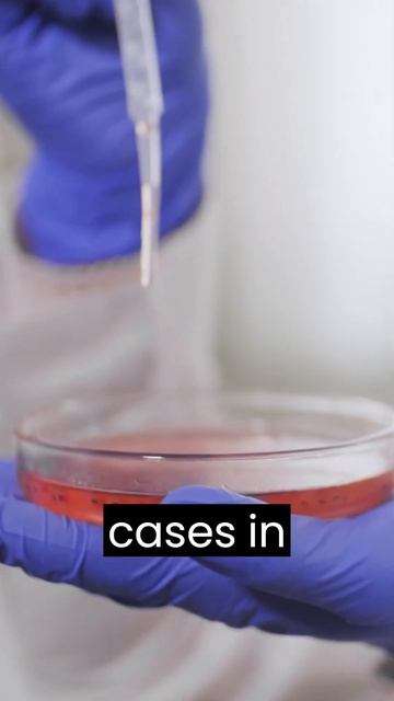 The Spreading of Candida Auris #1MinuteFacts #science #fungus #knowledge #information #shorts