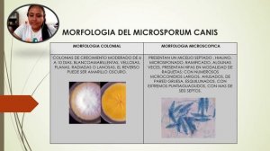 MICROSPORUM CANIS