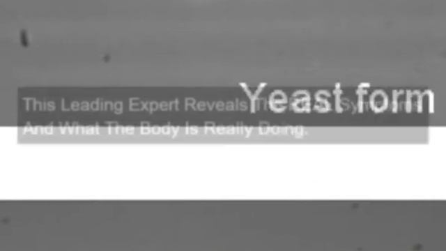 Candida Albicans Diet смотреть онлайн