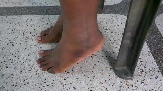 Exercises to fix Hallux valgus | Bunion correction exercises
