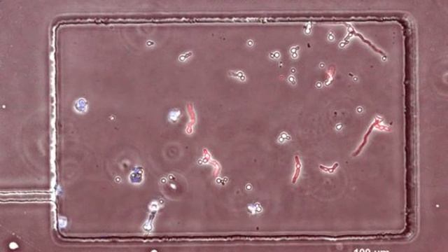 Microfluidic Arenas: Human neutrophils (blue) vs. Aspergillus fumigatus (red) смотреть онлайн