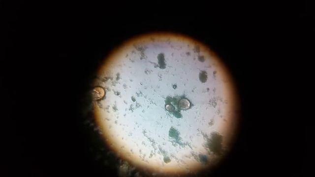 aspergillus with LPCB stain