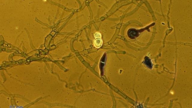 Basidiobolales | Wikipedia audio article смотреть онлайн