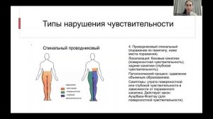 Чувствительные нарушения