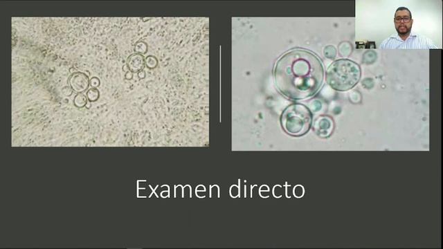 11. Micosis sistémicas. Paracoccidiodomicosis y Blastomicosis смотреть онлайн