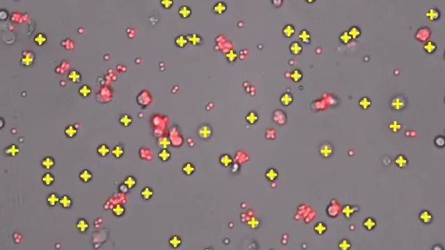 neutrophils with aspergillus with cell tracking software смотреть онлайн