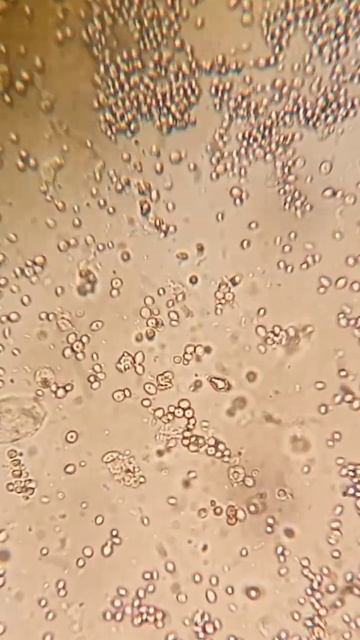 Yeast cells #lab #microscope #urine #medicaleducation #study #youtubeshorts  #bmlt #dmlt #laborator
