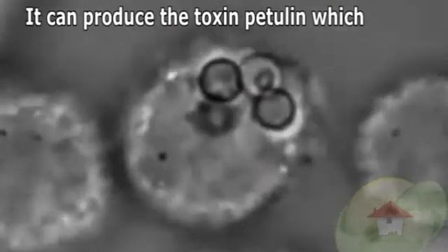 Aspergillus caesiellus смотреть онлайн