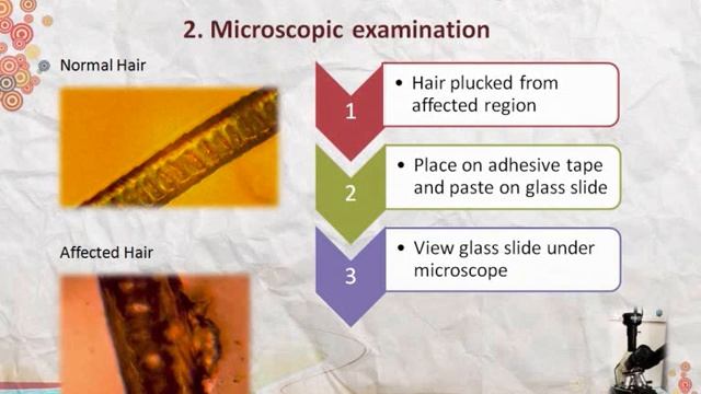 Dermatophytosis - 4 methods of diagnosis
