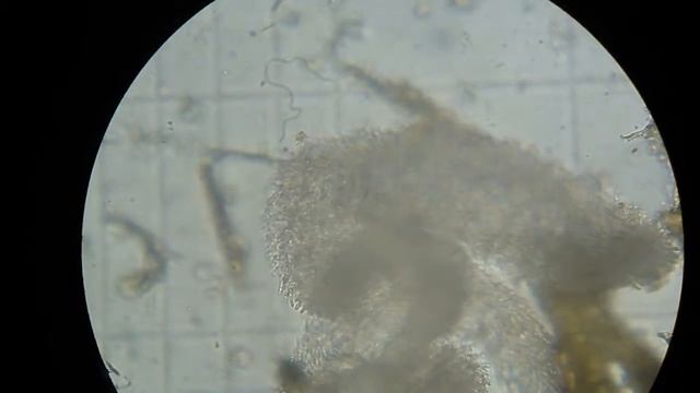 Taxıl bitkilərində Quruma xəstəliyi və patogeni- Gaeumannomyces graminis var. tritici смотреть онлайн
