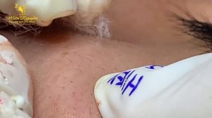 Satisfying Hien Spa Beauty Relaxing Video #18