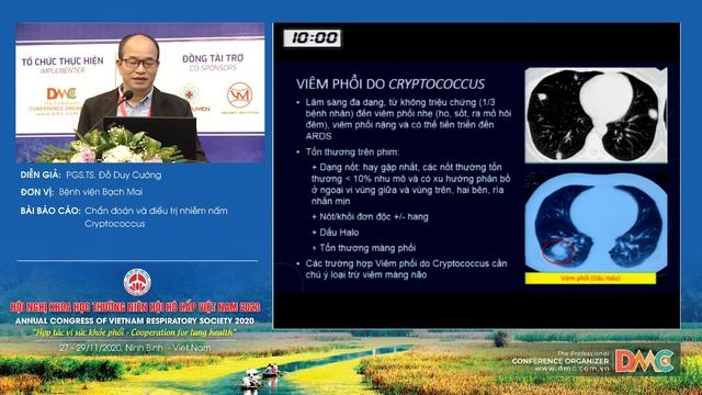 Chẩn đoán và điều trị nhiễm nấm Cryptococcus