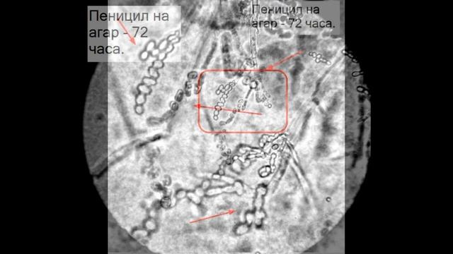 Penicillium смотреть онлайн