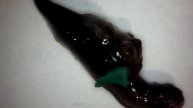 What is Morgellons Disease? Morgellons Is a Fungi (Aspergillus Fumigatus) - Highly Contagious
