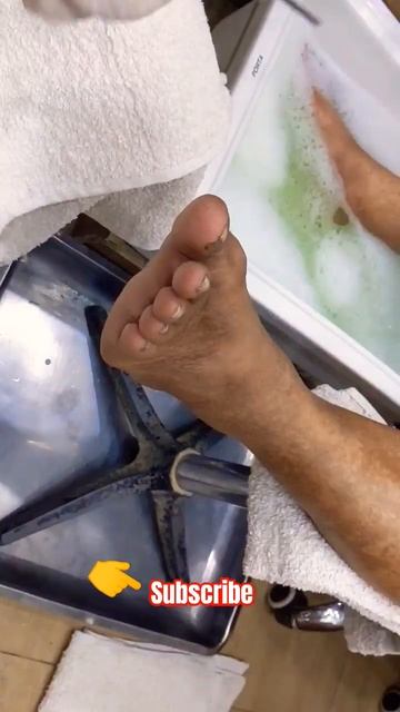 treatment of fungal #pedicure #calluses #fungus #fungalinfection смотреть онлайн