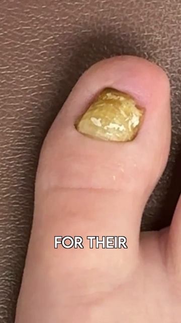 This NEEDS removed! #shorts смотреть онлайн