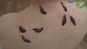 Прием невролога в клинике "Юнитек"