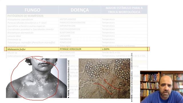 DIMORFISMO FÚNGICO смотреть онлайн