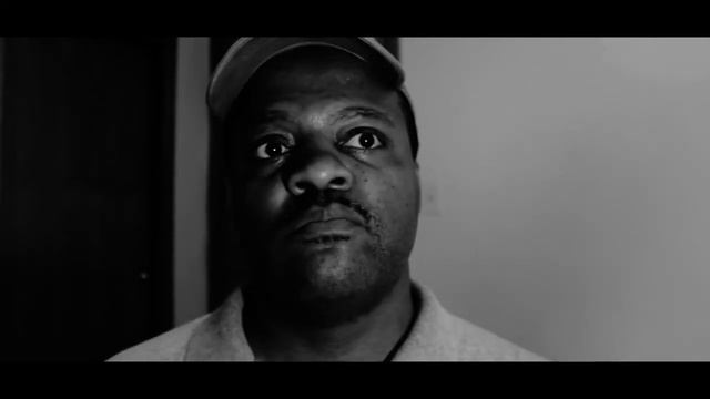 Candidiasis and Candida Albicans. Are you suffering from this?? PART 1 смотреть онлайн