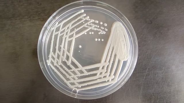 Candida albicans colony characteristics on Sabouraud dextrose agar (SDA) Demonstration