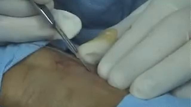 CIRCULACION VASCULAR LAB (Circulacion Laboratorio Vascular) смотреть онлайн