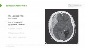 1.08 Epidural Hematoma & Subdural Hematoma