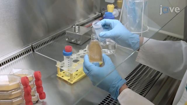 TAP-Tagged Histone Deacetylase Enrichment for Enzymatic Activity Assay | Protocol Preview