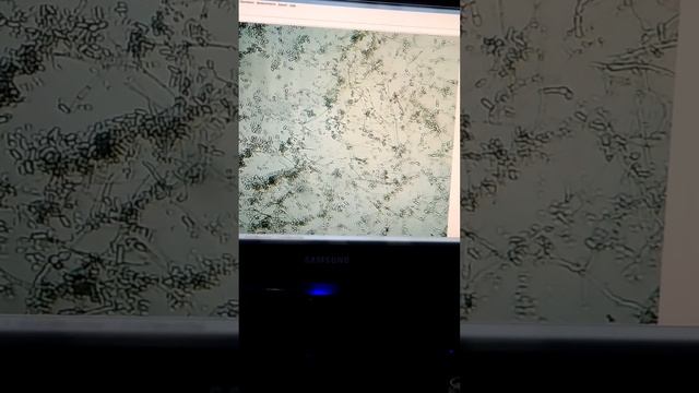 Fusarium oxysfourm funges live Activity by microscope смотреть онлайн
