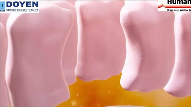 Autoimmune Gastrointestinal Disease Diagnosis