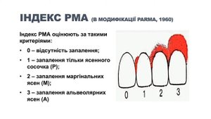 Індексна оцінка стану тканин пародонта (РМА).