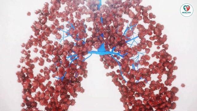 Unlocking the Secrets of Pneumocystis Pneumonia: A Comprehensive Guide to PCP | Healthy Care