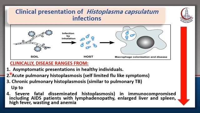 Microbiology : Respiratory fungal infections смотреть онлайн