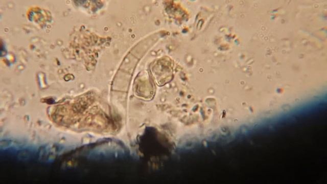 Penampakan fusarium di microscope penyebab mati layu pada tanaman смотреть онлайн