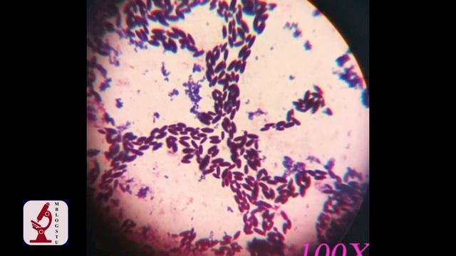 Identification of Fungi