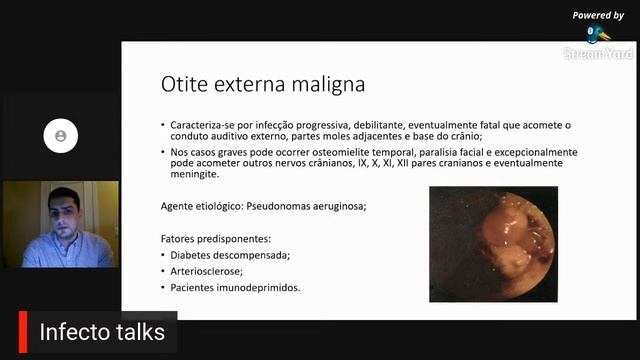 Infecto talks: Otites: Dicas que todo clinico precisa saber смотреть онлайн