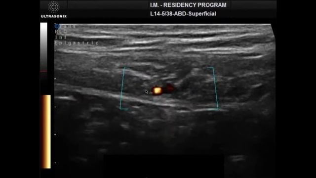AIUM/ACP/SUSME Webinar: Basic Abdominal POCUS for the General Internist смотреть онлайн