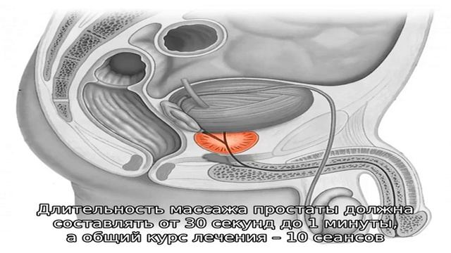 Симптомы простатита и лечение в домашних условиях