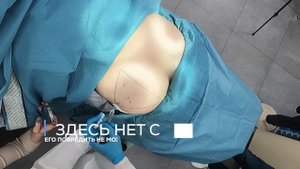 Пример техники введение Плексатрона в Грушевидную мышцу.