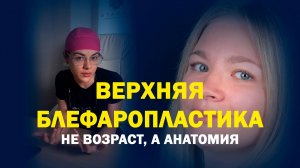 Верхняя блефаропластика для молодой девушки: больше никаких проблем!