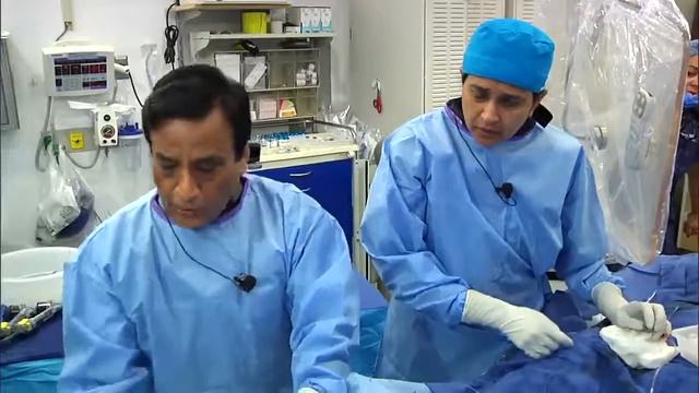 PCI of Heavily Calcified Unprotected Distal LM Lesion using Atherectomy & 2-Stent Approach -Jul 201