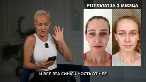 СИНЯКИ ПОД ГЛАЗАМИ УШЛИ/ДУМАЛА ЭТО ГЕНЕТИКА