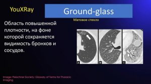 Глоссарий Флейшнеровского общества 2024 - Часть 1 Патоморфологические описательные термины