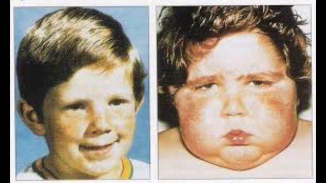 Dr. Medine Dilbazi - Tezyiqin endokrin sebebleri смотреть онлайн