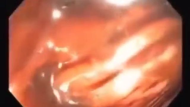 Здоровье нашего кишечника. смотреть онлайн