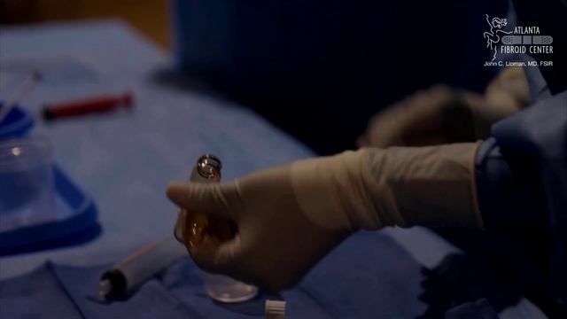 Uterine Fibroid Embolization (UFE) - Full Procedure Video - Atlanta Fibroid Center