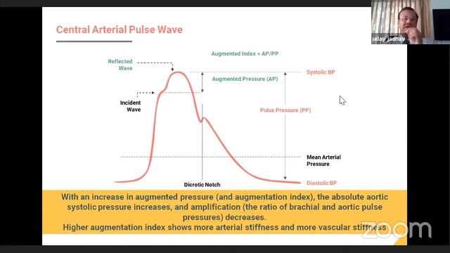 Measurements of Blood Pressure:One Size Fits All Approach? webinar With Dr Tiny, Dr Bansal & Dr Uda
