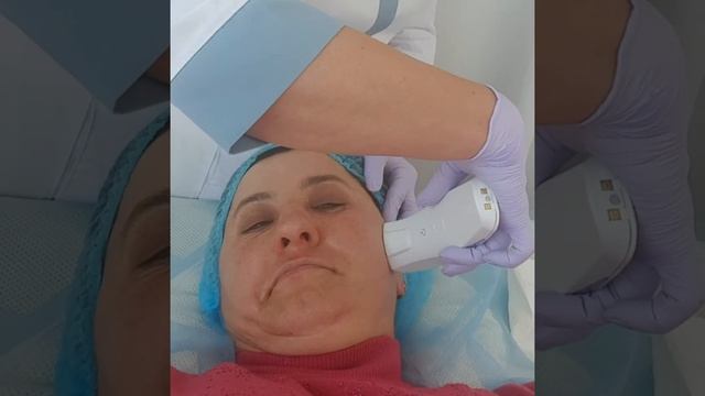 Ультразвукова чистка шкіри обличчя, та гальванічне введення сироватки. Вводить Тетяна Угринюк.❤ смотреть онлайн